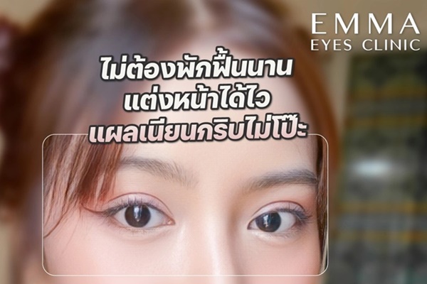 ออกแบบตาสองชั้นให้สวยคม โดยแพทย์เฉพาะทาง Plastic Surgery