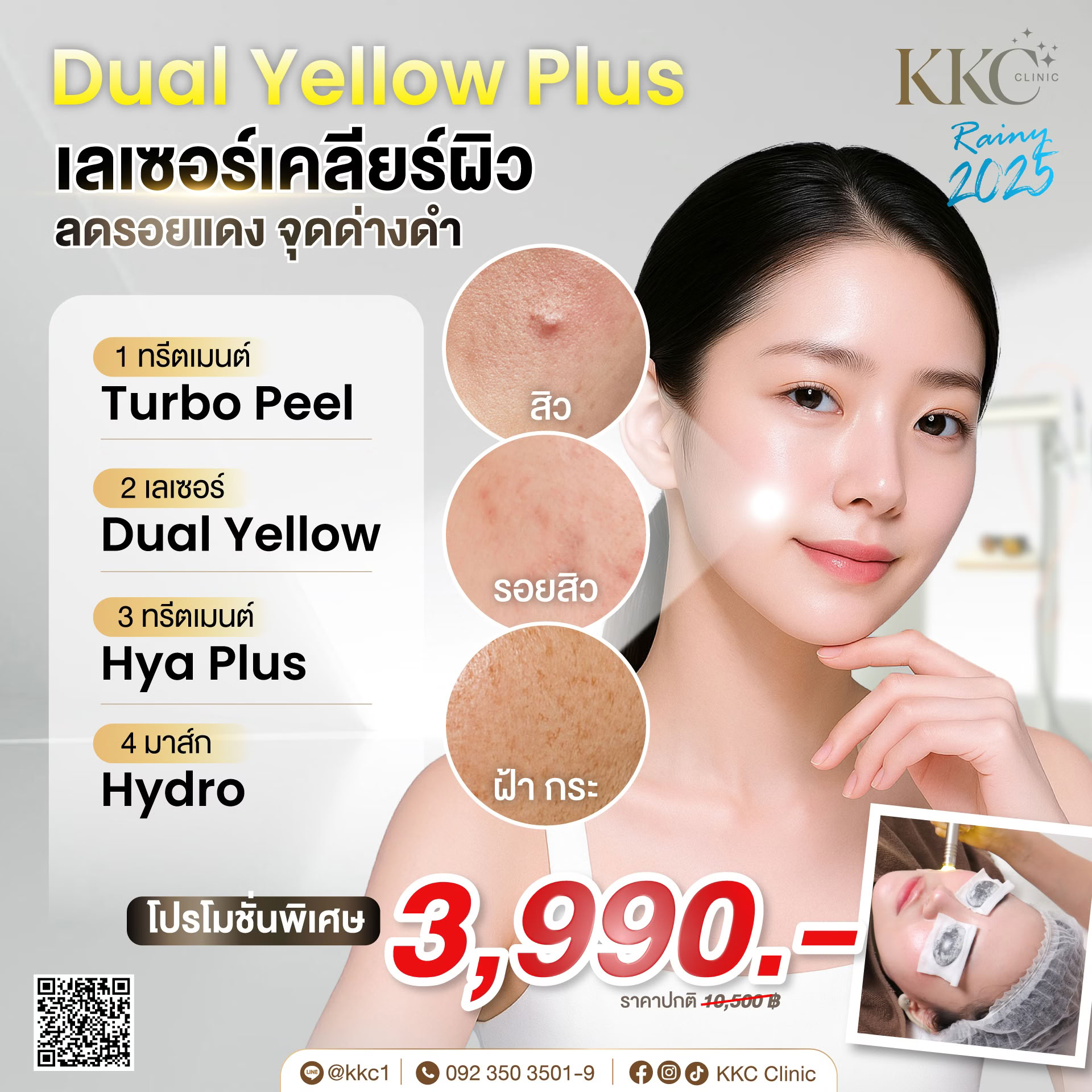 เลเซอร์เคลียร์ผิว ลดรอยแดง จุดด่างดำ-