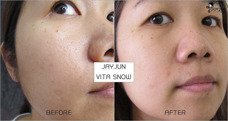 jayjun, review, รูขุมขน, รูขุมขนกระชับ, รูขุมขนเล็กลง, หน้ามัน, ผงวิตามินซี, vita snow, crystal nano