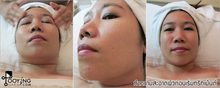 phillip wain, treatment, facial treatment, ทรีทเม้นต์หน้า, หน้าเรียว, นวดกดจุด, นวดกดจุดหน้า, magnetic tool