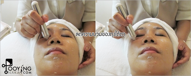 phillip wain, treatment, facial treatment, ทรีทเม้นต์หน้า, หน้าเรียว, นวดกดจุด, นวดกดจุดหน้า, magnetic tool