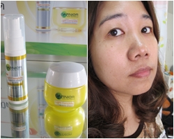 โปรแกรม 3 วัน...จุดด่างดำจางลงจริงหรือ กับ Garnier Light Complete White Speed Super Essence และ Serum Cream