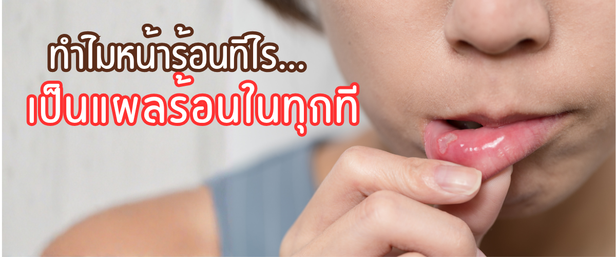 แผลร้อนใน
