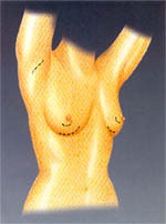รูปประกอบกระทู้