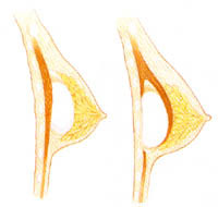 รูปประกอบความคิดเห็น